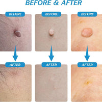 dermaÉCLAT Precision Revival System