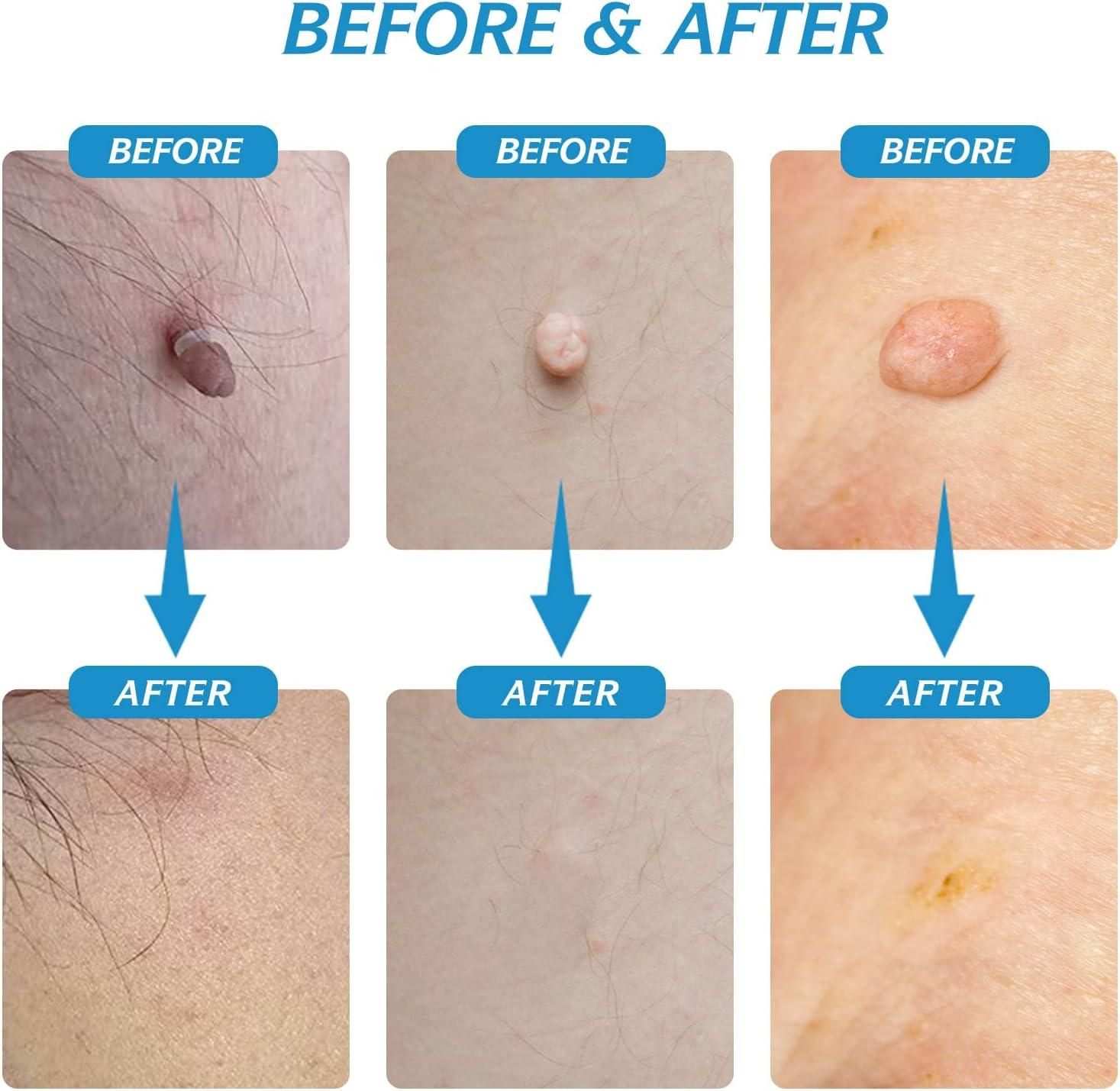 dermaÉCLAT Precision Revival System