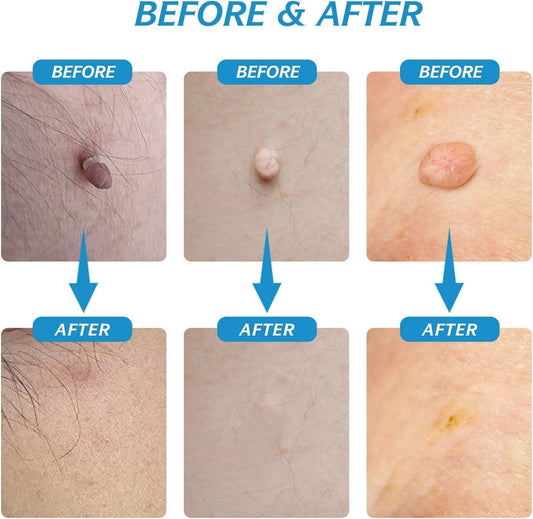 dermaÉCLAT Precision Revival System