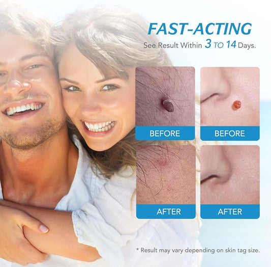 dermaÉCLAT Precision Revival System