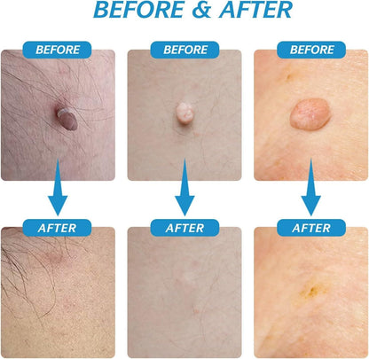 dermaÉCLAT Precision Revival System